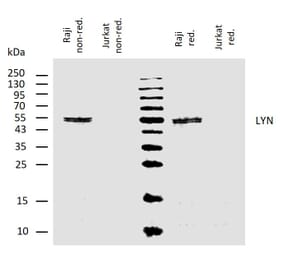 WB - Anti-Lyn Antibody [LYN-01] (A86683)