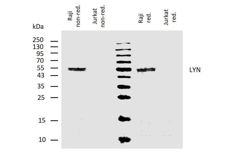 WB - Anti-Lyn Antibody [LYN-01] (A86683)