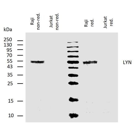 WB - Anti-Lyn Antibody [LYN-01] (A86683)