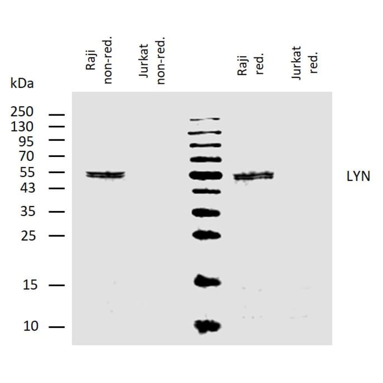 WB - Anti-Lyn Antibody [LYN-01] (A86683)