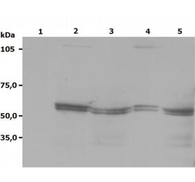 Western Blot - Anti-LYN Antibody [LYN-01] (A86682) - Antibodies.com