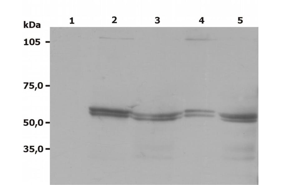Western Blot - Anti-LYN Antibody [LYN-01] (A86682) - Antibodies.com
