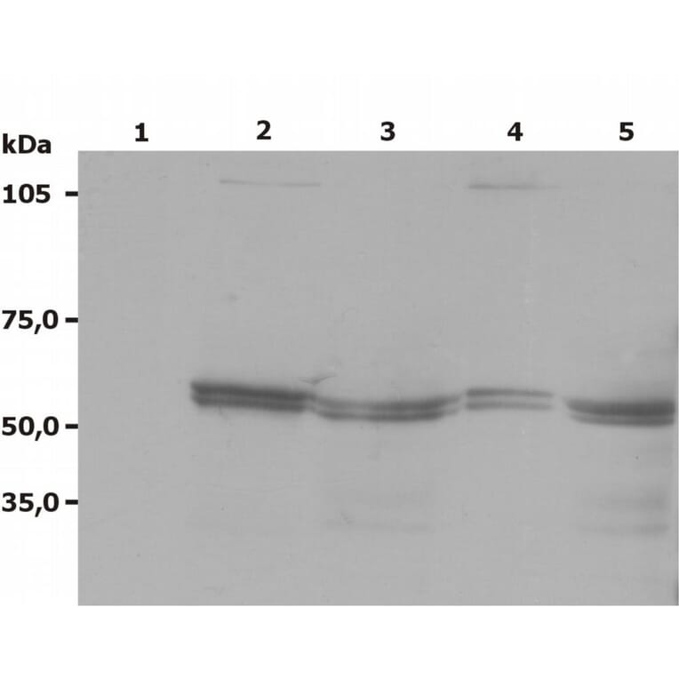 Western Blot - Anti-LYN Antibody [LYN-01] (A86682) - Antibodies.com