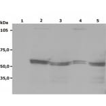 Western Blot - Anti-LYN Antibody [LYN-01] (A86682) - Antibodies.com