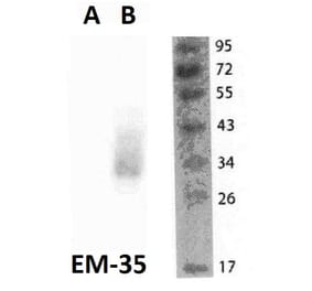WB - Anti-FOLR2 Antibody [EM-35] (A86684)