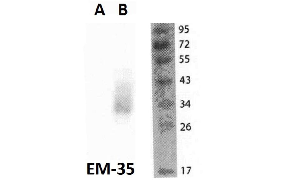 WB - Anti-FOLR2 Antibody [EM-35] (A86684)