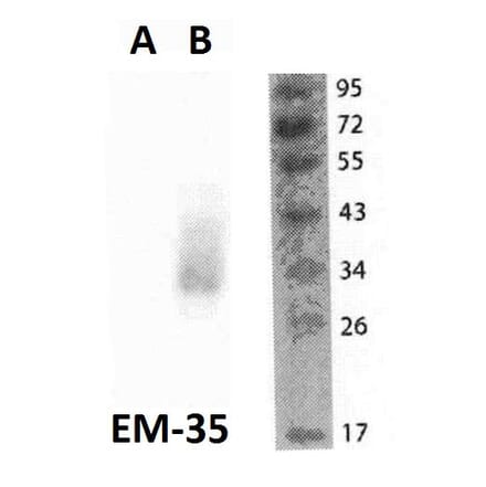 WB - Anti-FOLR2 Antibody [EM-35] (A86684)