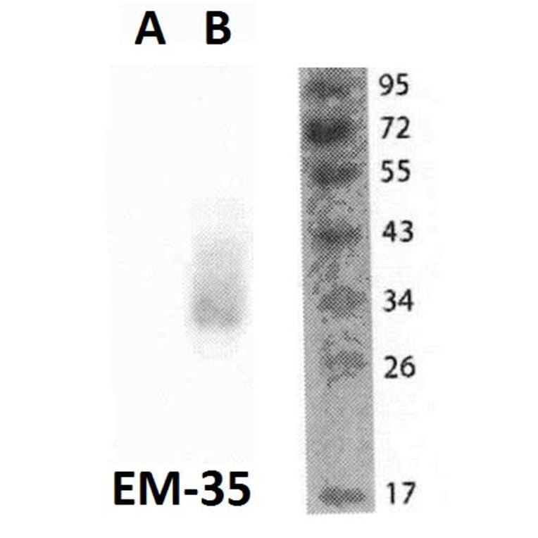 WB - Anti-FOLR2 Antibody [EM-35] (A86684)