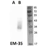 WB - Anti-FOLR2 Antibody [EM-35] (A86684)