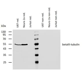 WB - Anti-beta III Tubulin Antibody [TU-20] (A86691)