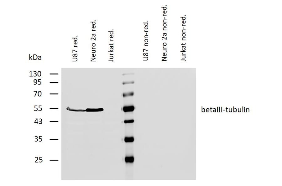 WB - Anti-beta III Tubulin Antibody [TU-20] (A86691)