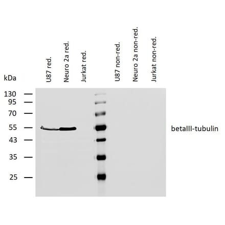 WB - Anti-beta III Tubulin Antibody [TU-20] (A86691)