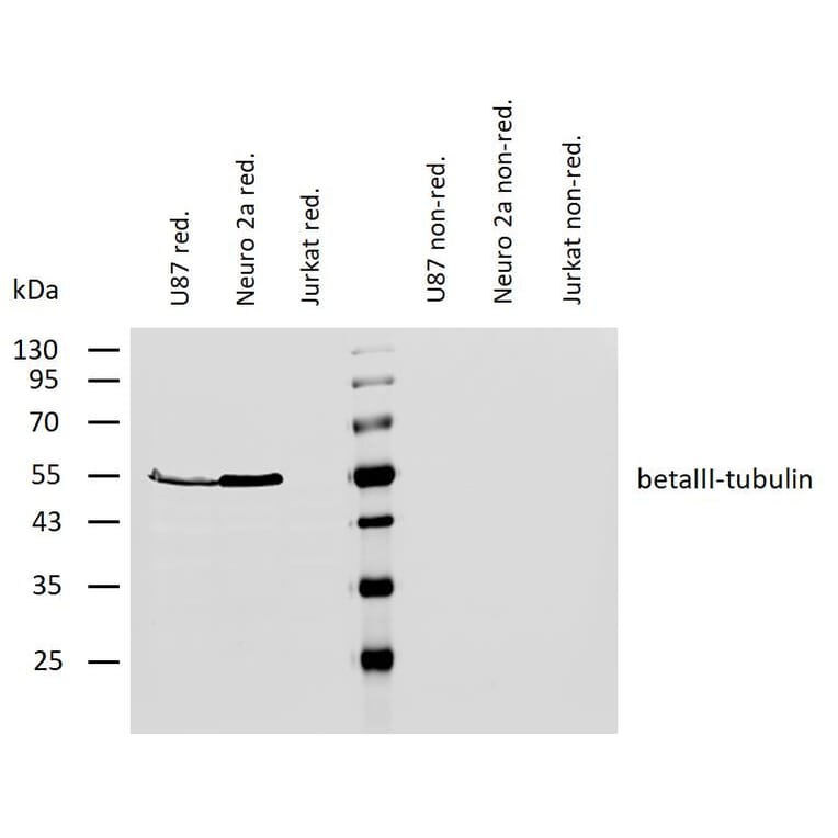 WB - Anti-beta III Tubulin Antibody [TU-20] (A86691)