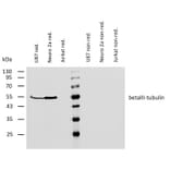 WB - Anti-beta III Tubulin Antibody [TU-20] (A86691)