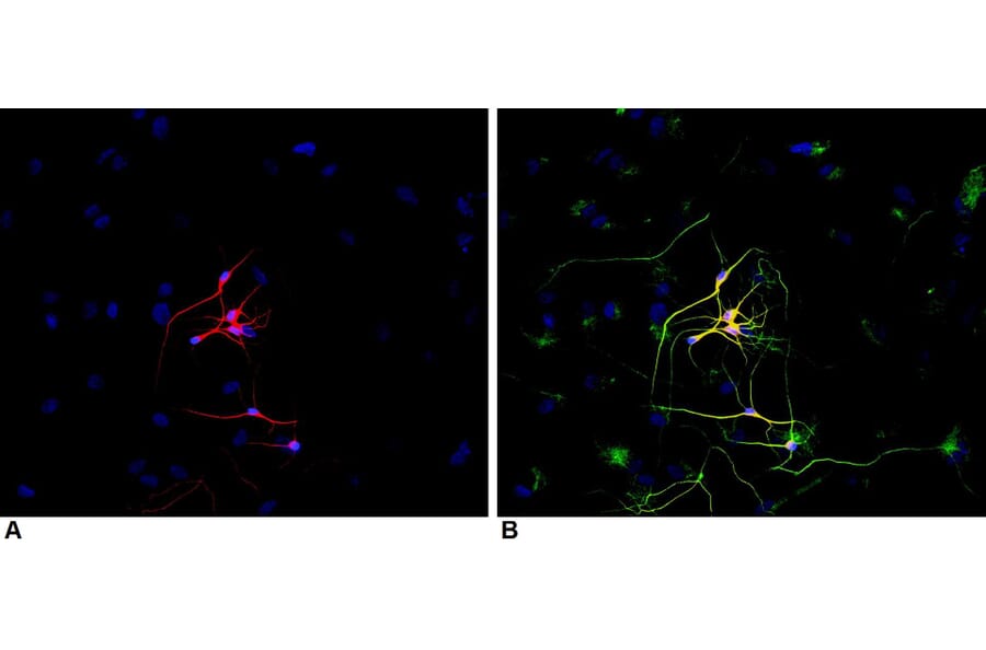 ICC - Anti-beta III Tubulin Antibody [TU-20] (A86691)