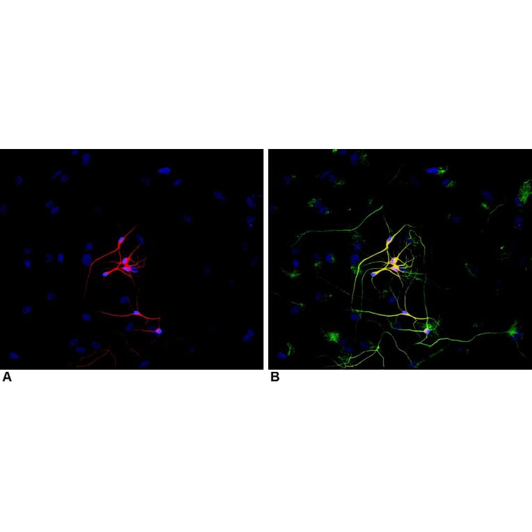 ICC - Anti-beta III Tubulin Antibody [TU-20] (A86691)