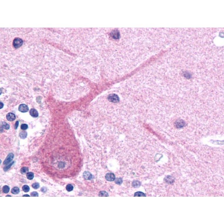 IHC - Anti-beta III Tubulin Antibody [TU-20] (A86691)