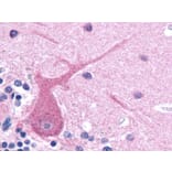 IHC - Anti-beta III Tubulin Antibody [TU-20] (A86691)