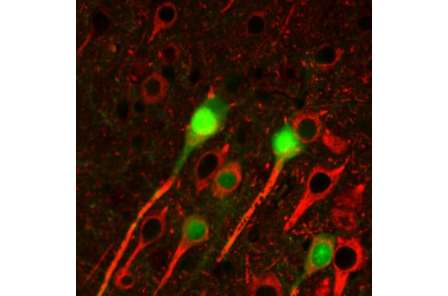 IHC - Anti-beta III Tubulin Antibody [TU-20] (A86691)