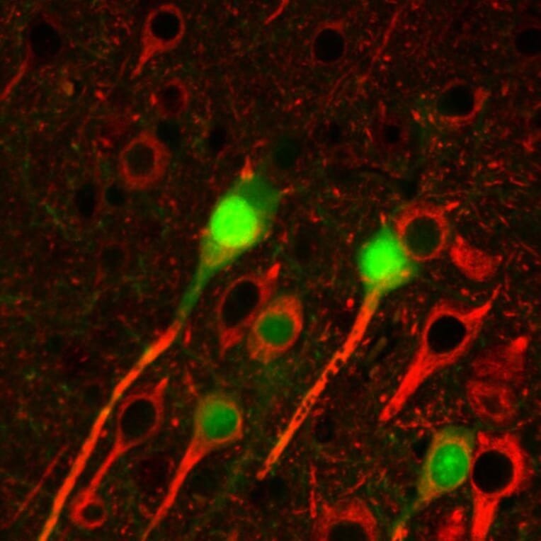 IHC - Anti-beta III Tubulin Antibody [TU-20] (A86691)