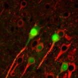IHC - Anti-beta III Tubulin Antibody [TU-20] (A86691)