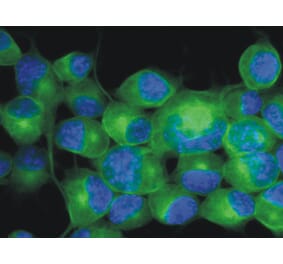 Immunocytochemistry - Anti-beta III Tubulin Antibody [TU-20] (A86689) - Antibodies.com