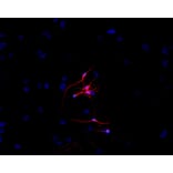 Immunocytochemistry - Anti-beta III Tubulin Antibody [TU-20] (A86691) - Antibodies.com