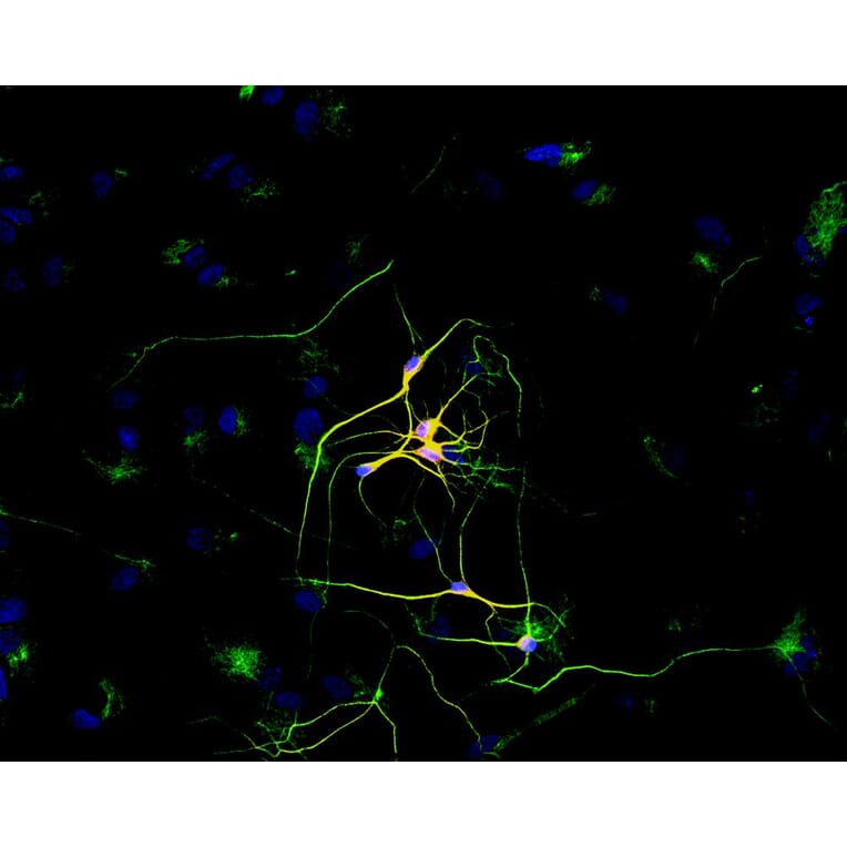 Immunocytochemistry - Anti-beta III Tubulin Antibody [TU-20] (A86691) - Antibodies.com