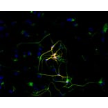 Immunocytochemistry - Anti-beta III Tubulin Antibody [TU-20] (A86691) - Antibodies.com