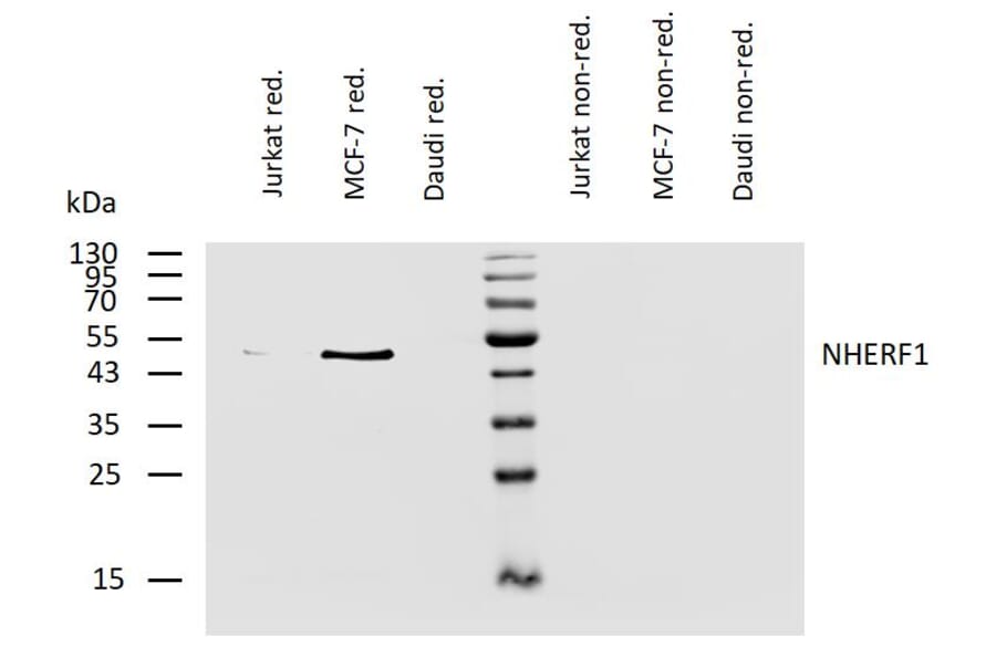 WB - Anti-EBP50/NHERF-1 Antibody [EBP-10] (A86695)