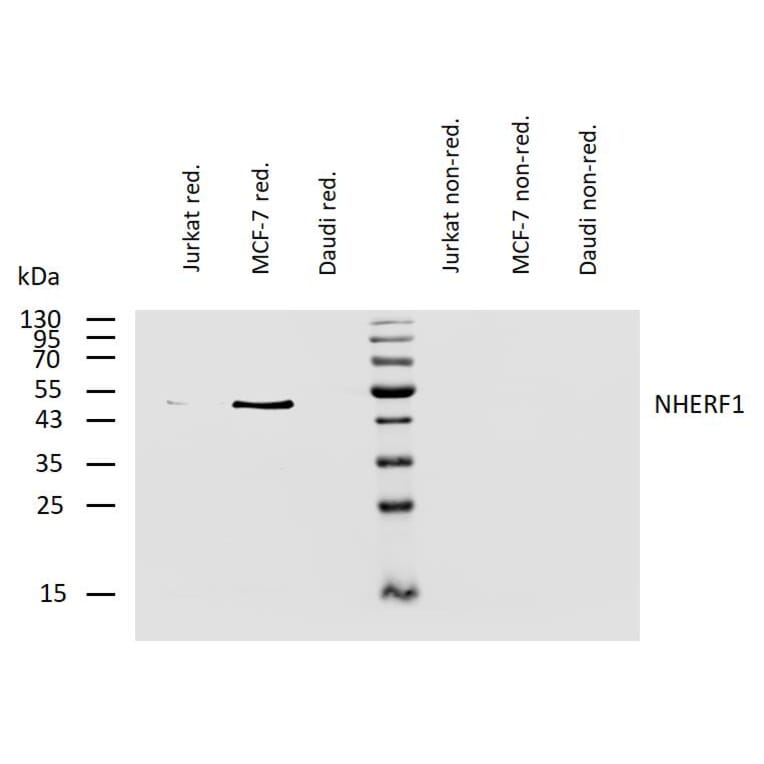 WB - Anti-EBP50/NHERF-1 Antibody [EBP-10] (A86695)