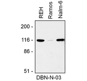 WB - Anti-Drebrin Antibody [DBN-N-03] (A86706)