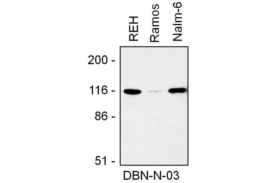 WB - Anti-Drebrin Antibody [DBN-N-03] (A86706)