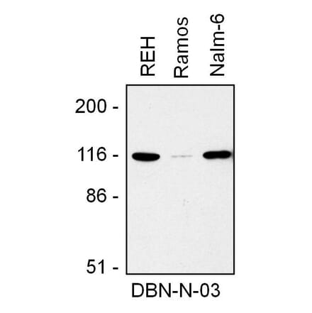 WB - Anti-Drebrin Antibody [DBN-N-03] (A86706)