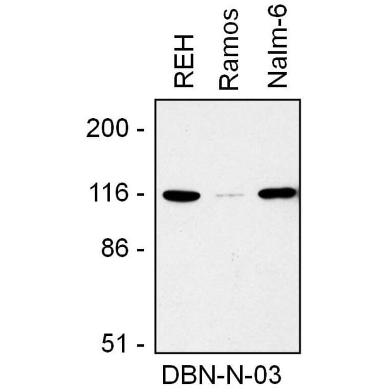 WB - Anti-Drebrin Antibody [DBN-N-03] (A86706)