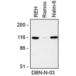 WB - Anti-Drebrin Antibody [DBN-N-03] (A86706)