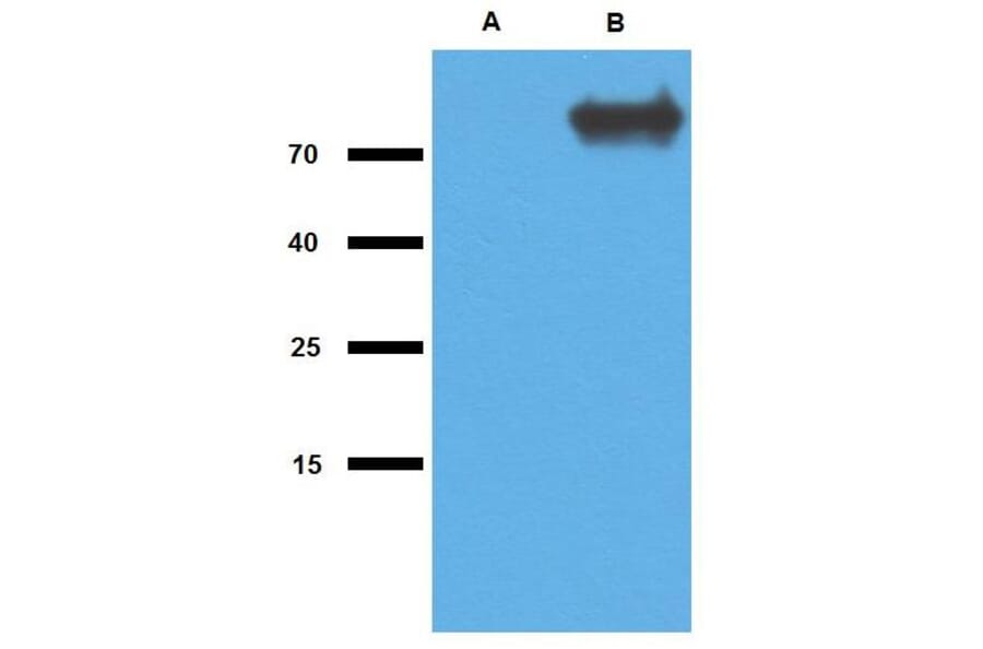 WB - Anti-Mycobacterium tuberculosis GlcB Antibody (A86707)