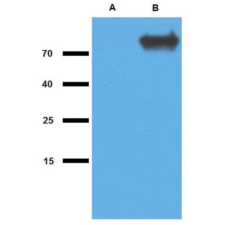 WB - Anti-Mycobacterium tuberculosis GlcB Antibody (A86707)