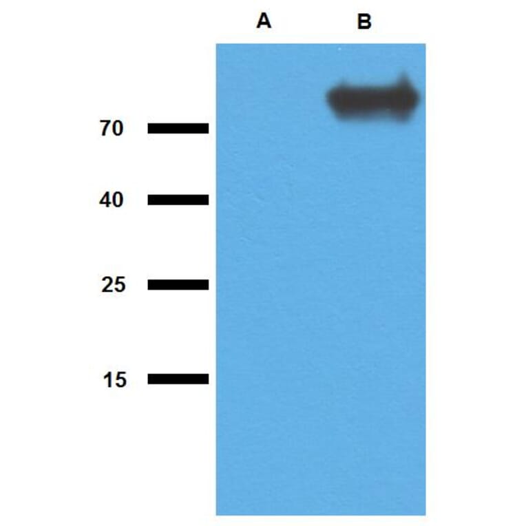 Western Blot - Anti-Mycobacterium tuberculosis GlcB Antibody (A86706) - Antibodies.com