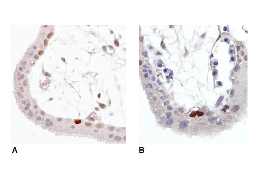 IHC - Anti-p53 (phospho S392) Antibody [FP3.2 [FPS392]] (A86708)