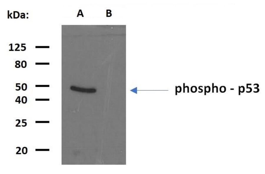 WB - Anti-p53 (phospho S392) Antibody [FP3.2 [FPS392]] (A86708)