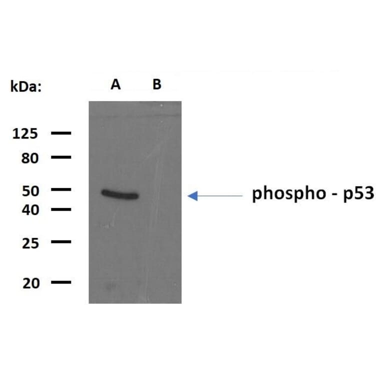 WB - Anti-p53 (phospho S392) Antibody [FP3.2 [FPS392]] (A86708)