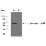WB - Anti-p53 (phospho S392) Antibody [FP3.2 [FPS392]] (A86708)