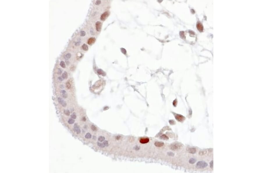 Immunohistochemistry - Anti-p53 (phospho Ser392) Antibody [FP3.2 [FPS392]] (A86708) - Antibodies.com