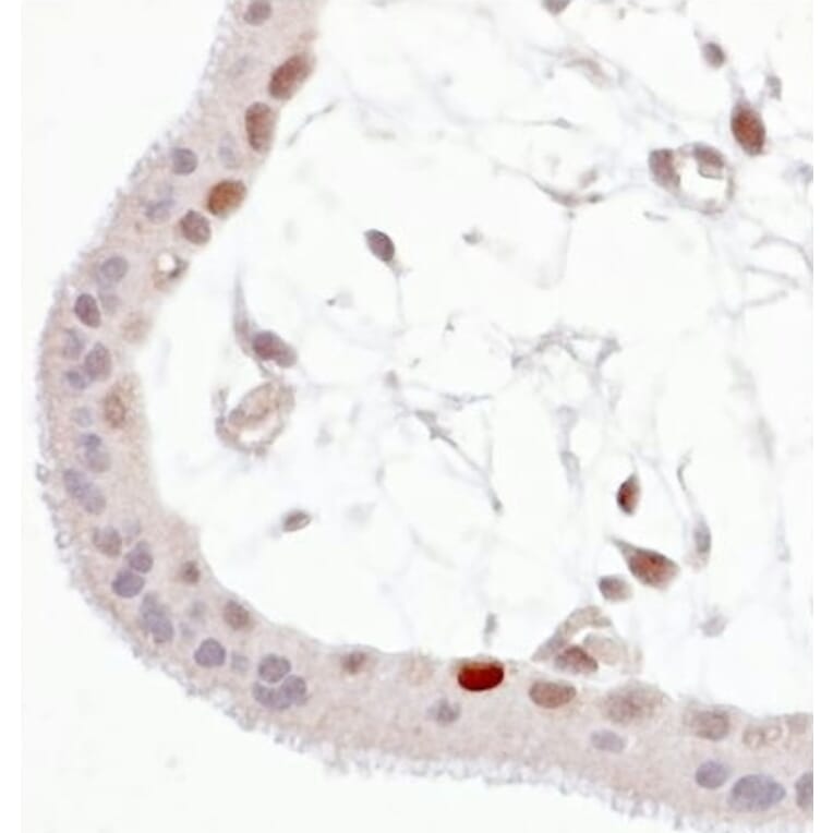 Immunohistochemistry - Anti-p53 (phospho Ser392) Antibody [FP3.2 [FPS392]] (A86708) - Antibodies.com