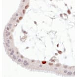 Immunohistochemistry - Anti-p53 (phospho Ser392) Antibody [FP3.2 [FPS392]] (A86708) - Antibodies.com