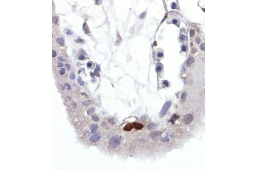 Immunohistochemistry - Anti-p53 (phospho Ser392) Antibody [FP3.2 [FPS392]] (A86707) - Antibodies.com