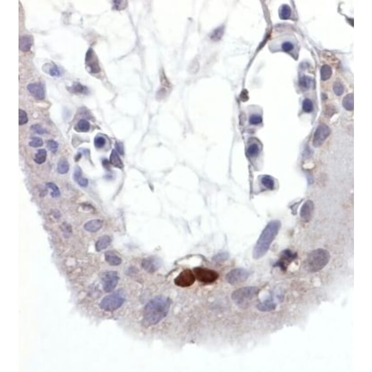 Immunohistochemistry - Anti-p53 (phospho Ser392) Antibody [FP3.2 [FPS392]] (A86707) - Antibodies.com