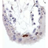Immunohistochemistry - Anti-p53 (phospho Ser392) Antibody [FP3.2 [FPS392]] (A86707) - Antibodies.com