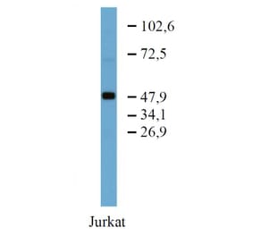 WB - Anti-TRK Fused Gene Antibody [TFG-03] (A86721)